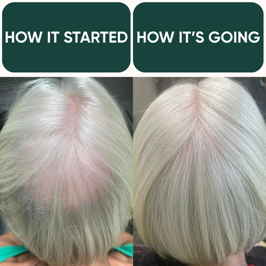 Rosemary Tonic - Water based Scalp Spray