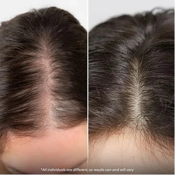 “Baby hairs everywhere!”