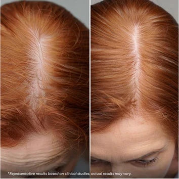 “My scalp feels normal again.”