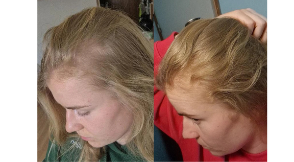 “My shedding finally calmed down.”